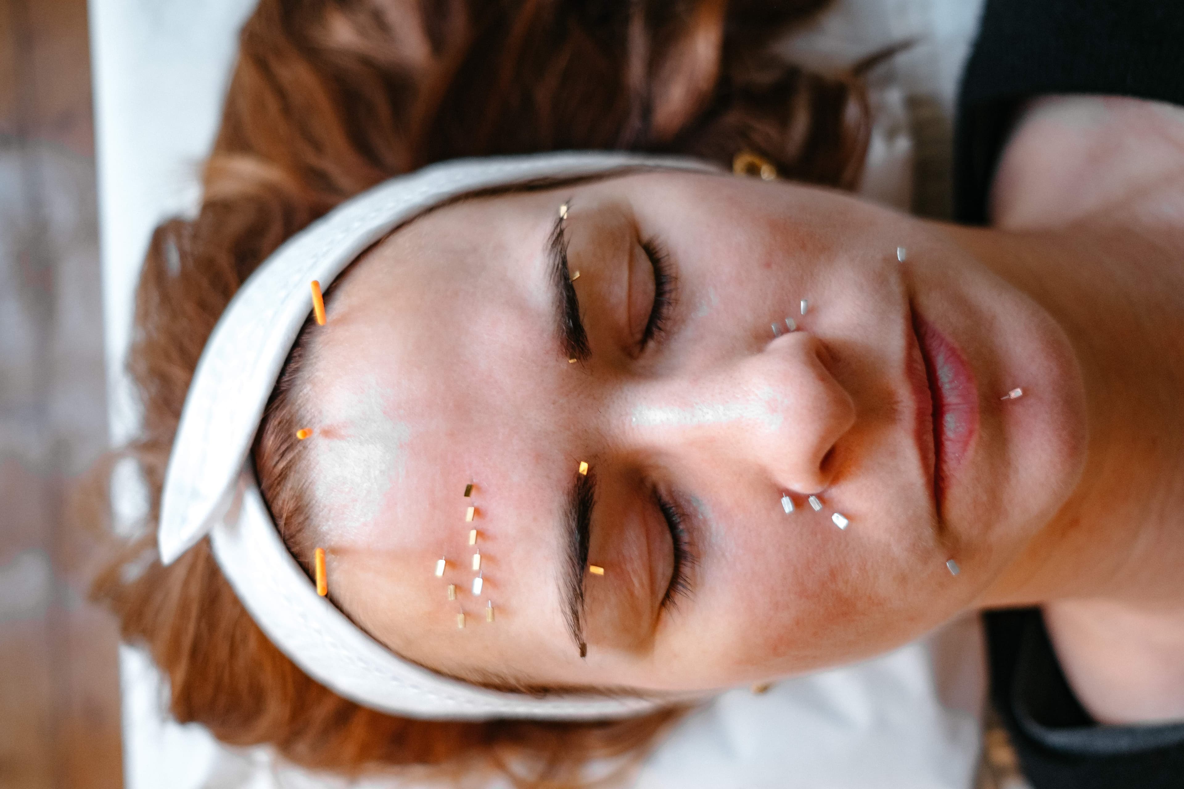 Rejuvenescimento Facial